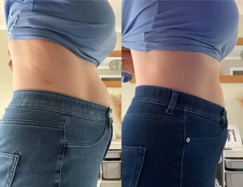 Antes e depois — Intestino funcionando melhor