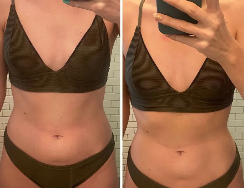 Antes e depois — Mais leveza e bem-estar